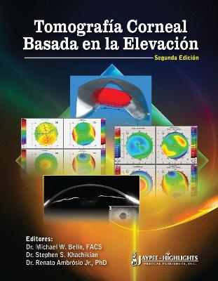 Tomografía Corneal Basada en la Elevación - Michael W. Belin, Stephen S Khachikian, Renato Ambrosio Jr