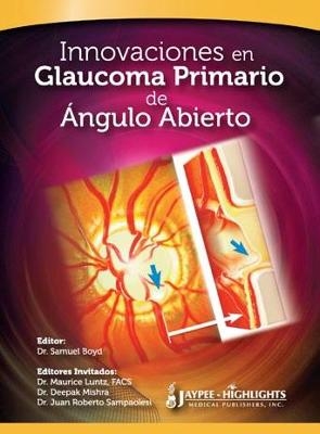 Innovaciones en Glaucoma Primario de Ángulo Abierto - Samuel Boyd, Maurice Luntz, Deepak Mishra, Juan Roberto Sampaolesi