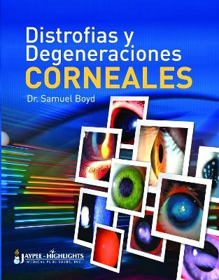 Distrofías y Degeneraciones Corneales - Samuel Boyd