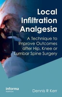 Local Infiltration Analgesia - 