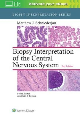 Biopsy Interpretation of the Central Nervous System - Matthew J. Schniederjan