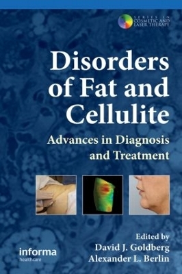 Disorders of Fat and Cellulite - 