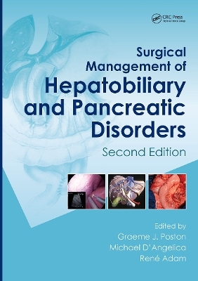 Surgical Management of Hepatobiliary and Pancreatic Disorders, Second Edition - 