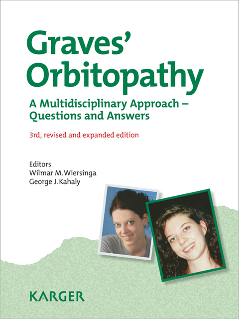 Graves' Orbitopathy - 