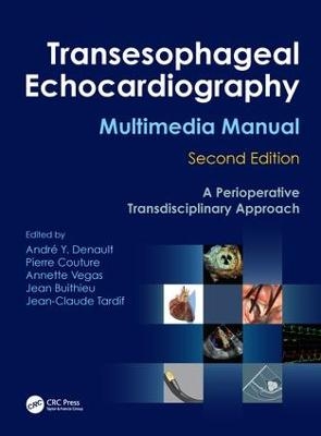 Transesophageal Echocardiography Multimedia Manual - 