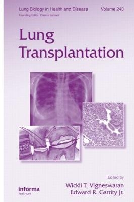 Lung Transplantation - 