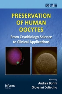 Preservation of Human Oocytes - 