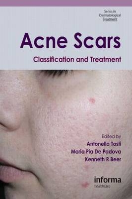 Acne Scars - 