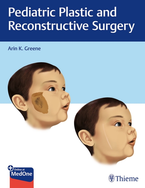 Pediatric Plastic and Reconstructive Surgery - 