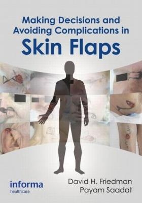 Making Decisions and Avoiding Complications in Skin Flaps - 