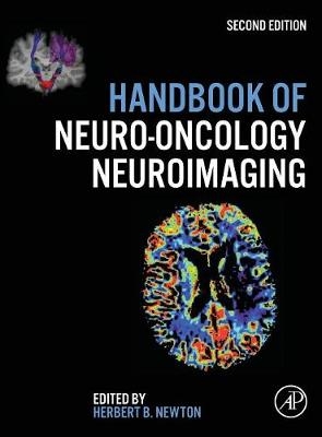 Handbook of Neuro-Oncology Neuroimaging - 