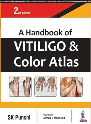 A Handbook of Vitiligo & Color Atlas - S. K. Punshi