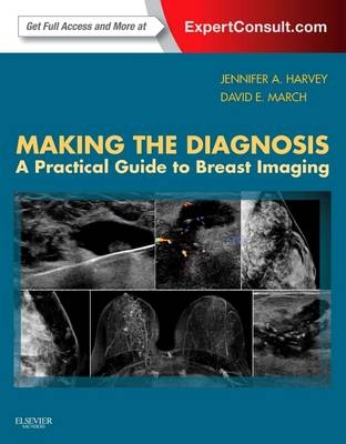 Making the Diagnosis: A Practical Guide to Breast Imaging - Jennifer Harvey, David E March