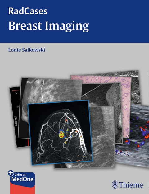 Breast Imaging RadCases - Lonie R. Salkowski