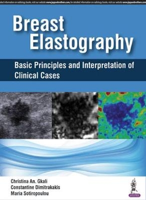 Breast Elastography - Christina An Gkali, Constantine Dimitrakakis, Maria Sotiropoulou