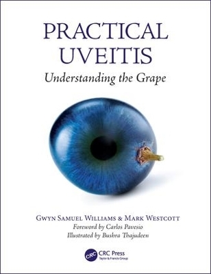 Practical Uveitis - Gwyn Samuel Williams, Mark Westcott