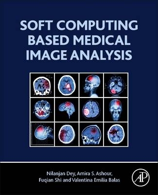 Soft Computing Based Medical Image Analysis - Nilanjan Dey, Amira S. Ashour, Fuquian Shi, Valentina Emilia Balas