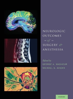 Neurologic Outcomes of Surgery and Anesthesia - 