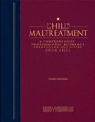 Child Maltreatment - Angelo P. Giardino, Randell Alexander