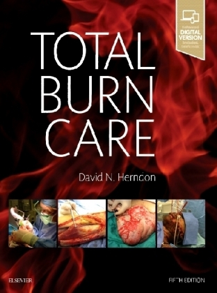 Total Burn Care - David N. Herndon