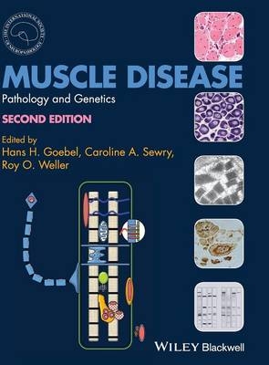 Muscle Disease - 