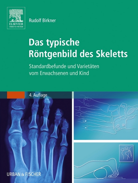 Das typische Röntgenbild des Skeletts - Rudolf Birkner