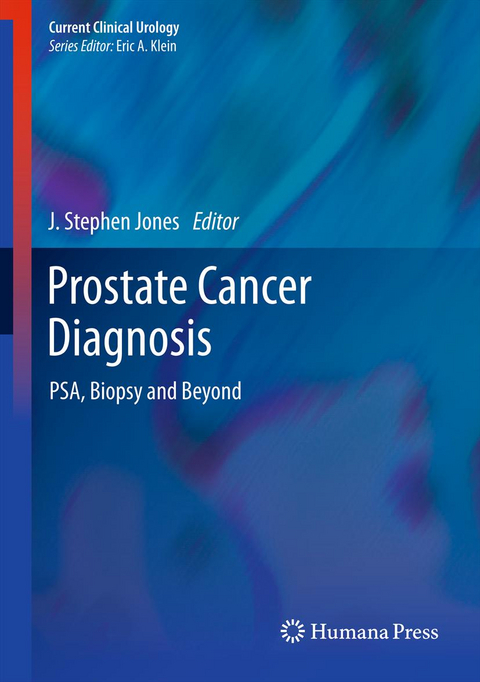 Prostate Cancer Diagnosis - 