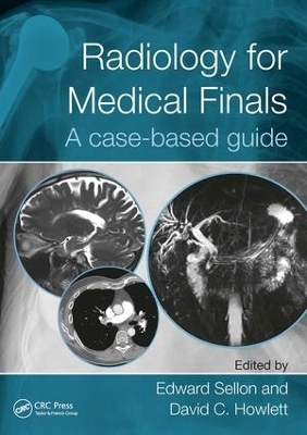 Radiology for Medical Finals - 