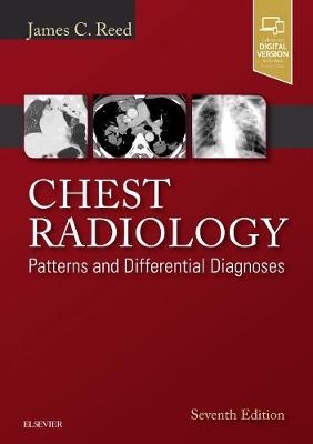 Chest Radiology - James C. Reed