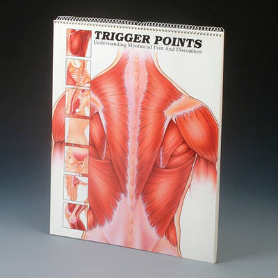 Trigger Points -  Anatomical Chart Company