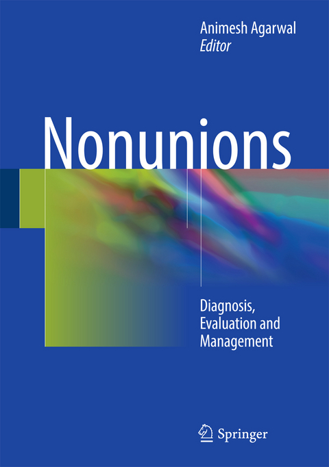 Nonunions - 