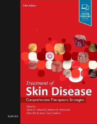 Treatment of Skin Disease - Mark G. Lebwohl, Warren R. Heymann, John Berth-Jones, Ian Coulson