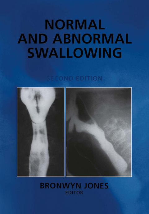 Normal and Abnormal Swallowing - 