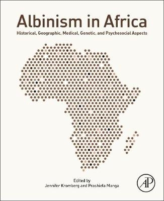 Albinism in Africa - 