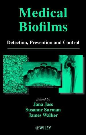 Medical Biofilms - Jana Jass, Susanne Surman