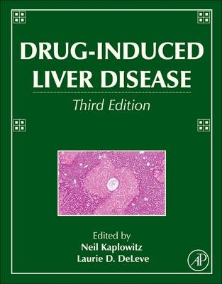 Drug-Induced Liver Disease - 