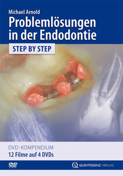 Problemlösungen in der Endodontie - Michael Arnold