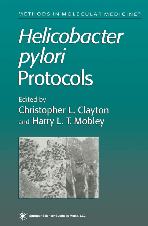 Helicobacter pylori Protocols - 