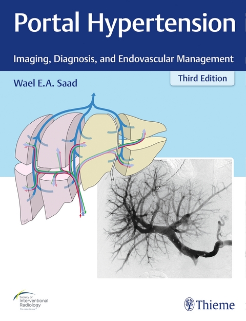 Portal Hypertension - Dr. Wael E. A. Saad