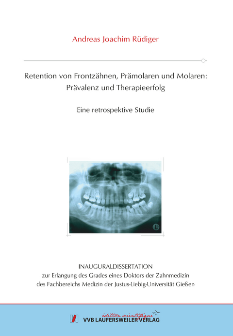 Retention von Frontzähnen, Prämolaren und Molaren: Prävalenz und Therapieerfolg - Andreas Joachim Rüdiger