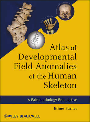 Atlas of Developmental Field Anomalies of the Humnan Skeleton – A Paleopathology Perspective - E Barnes