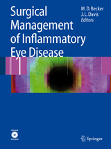 Surgical Management of Inflammatory Eye Disease - 