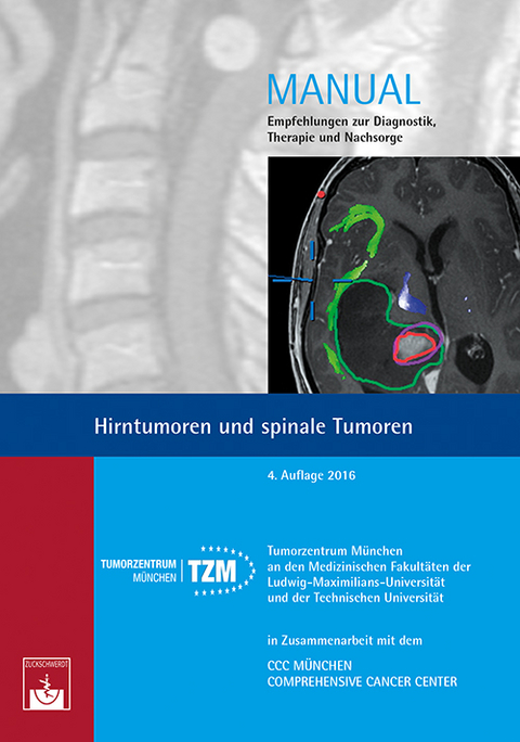 Hirntumoren und spinale Tumoren - 