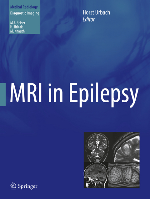 MRI in Epilepsy - 