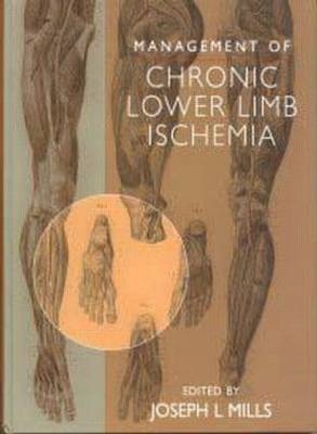 Management of Chronic Lower Limb Ischemia