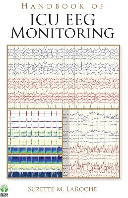 Handbook of ICU EEG Monitoring - 