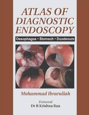 Atlas of Diagnostic Endoscopy - Mohammad Ibrarullah