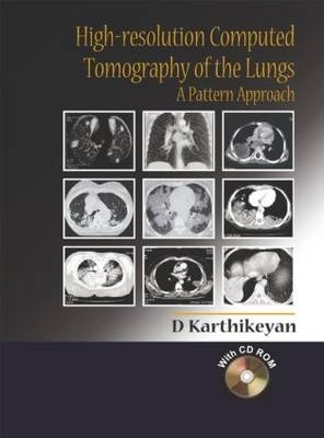 High-Resolution Computed Tomography of the Lungs: A Pattern Approach - D Karthikeyan