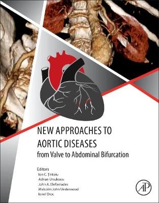 New Approaches to Aortic Diseases from Valve to Abdominal Bifurcation - 