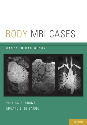 Body MRI Cases - Eduard E. de Lange